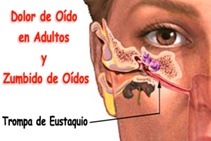 Dolor de oído en adultos - Zumbido de oídos